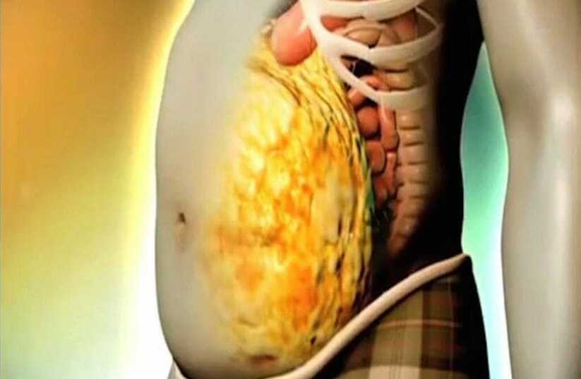 grasso-addominale-news-aipt